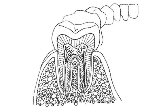 Anatomy of Teeth Embroidery Design Review